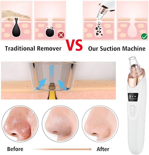 Rechargeable Blackhead Whitehead Remover Device For face Acne Pimple Pore Cleaner Vacuum Suction facial care Tool with adapter For Men & Women