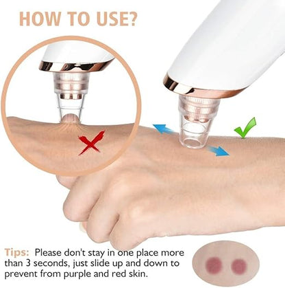 Rechargeable Blackhead Whitehead Remover Device For face Acne Pimple Pore Cleaner Vacuum Suction facial care Tool with adapter For Men & Women